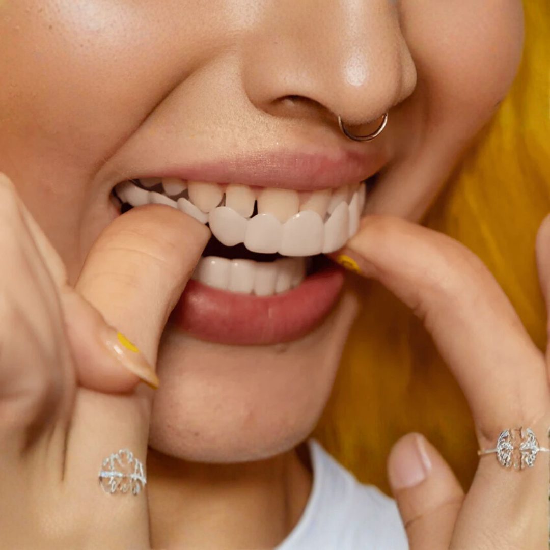 Licówki dentystyczne - SmileForm - Wyjmowane łuski - Naturalny kolor zębów