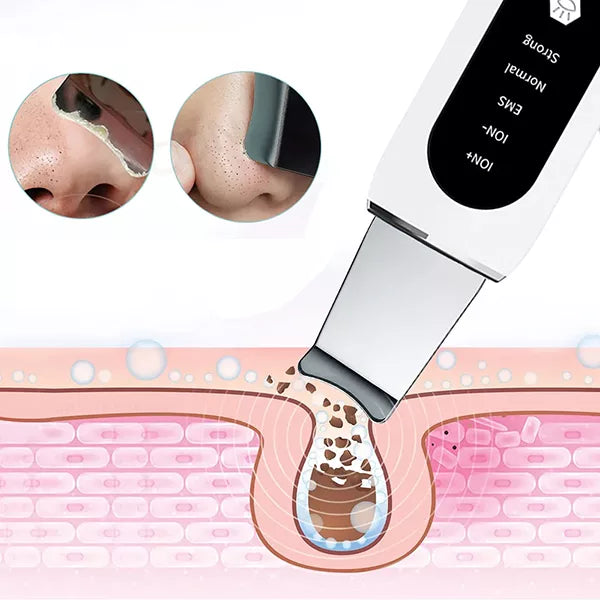 Ultradźwiękowy peeling do twarzy | Narzędzie do czyszczenia