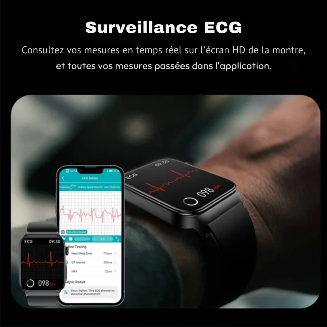 Montre intelligente ECG - VitalsTrack - Tensiomètre - Température corporelle